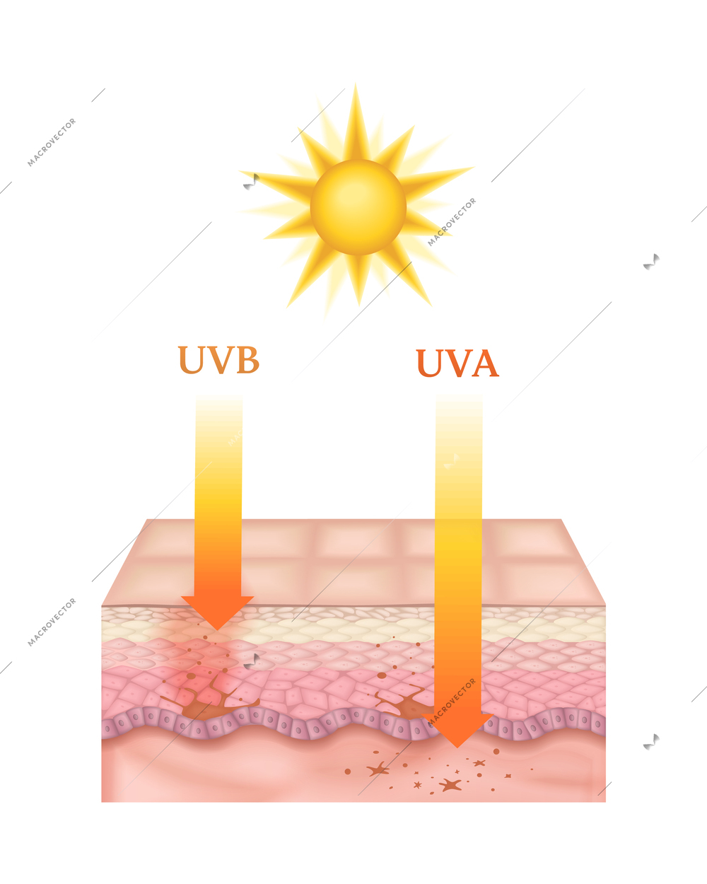 Realistic cross section of human skin layers affected by uva and uva sun rays vector illustration