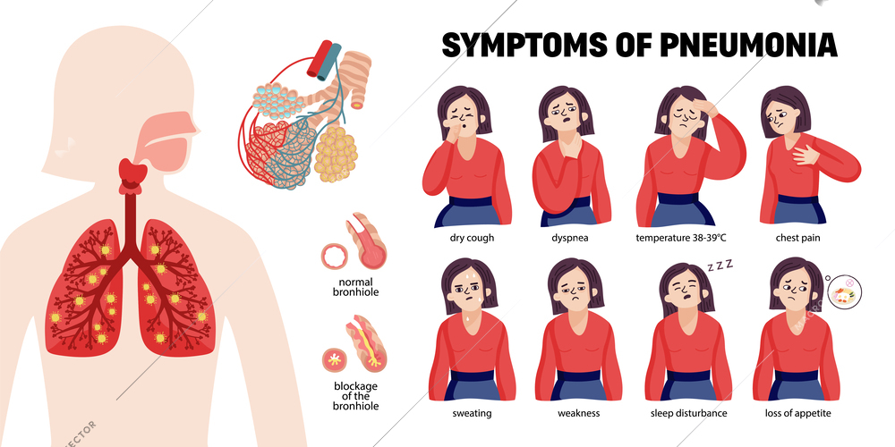 Human pneumonia infographics with female characters representing common symptoms and icons of bacteria cells with lungs vector illustration