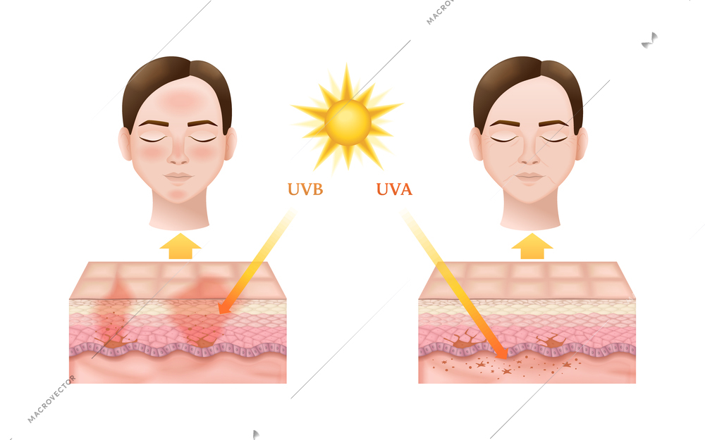 Realistic infographics showing how uvb and uva sun radiation types affect skin with anatomy of its layers and female faces vector illustration