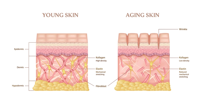 Realistic infographics with anatomical layers structure of young and aging human skin vector illustration