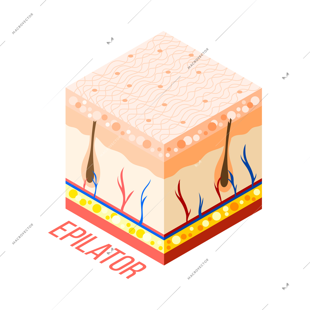 Hair removal isometric composition with 3d diagram of human skin with layers veins and hair roots vector illustration