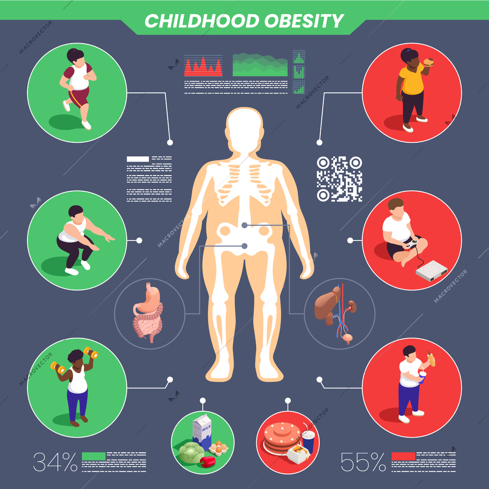 Childhood obesity infographic set with percentage and statistics symbols isometric vector illustration