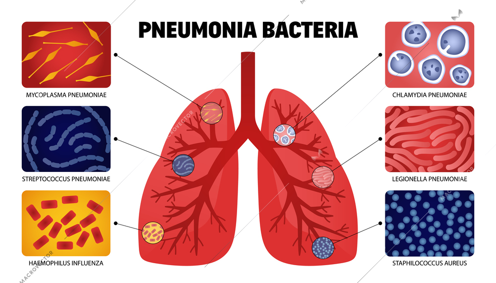 Human pneumonia bacteria set with isolated images of lungs anatomical shape with samples of infectious bacteria vector illustration