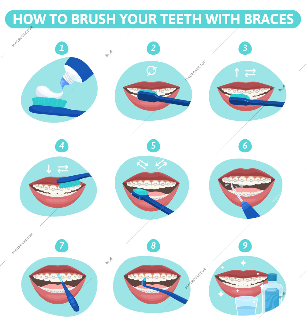 Dental hygiene flat set of round infographic compositions showing mouth stages of teeth cleanup with braces vector illustration