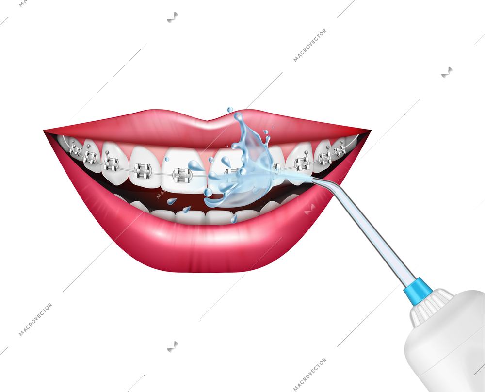 Teeth care oral hygiene realistic composition with dental irrigator cleaning braces vector illustration