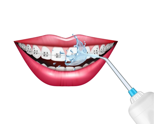 Teeth care oral hygiene realistic composition with dental irrigator cleaning braces vector illustration