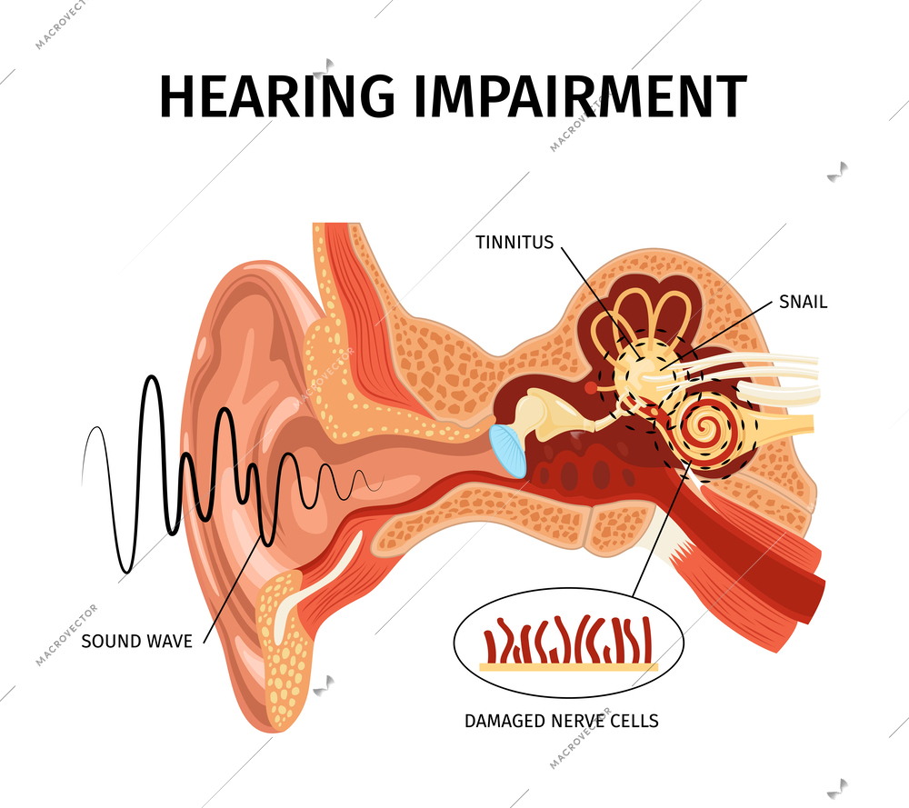 Realistic anatomy ear tinnitus composition with sound internal organs view with pointers and editable text captions vector illustration