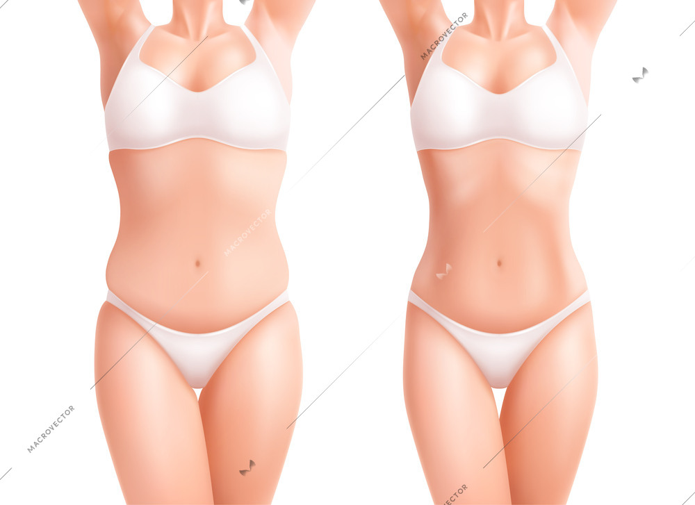 Female woman weight body set with before and after realistic views of skinny and fat bodies vector illustration