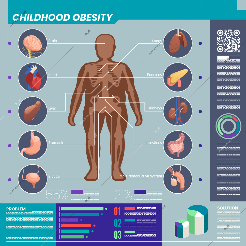 Childhood obesity and organs infographic set with healthcare symbols isometric vector illustration