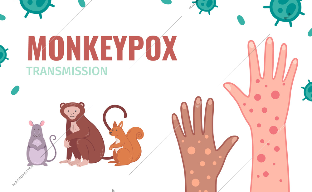 Monkey Pox Virus infographics with hand in rash and animal transmitters vector illustration