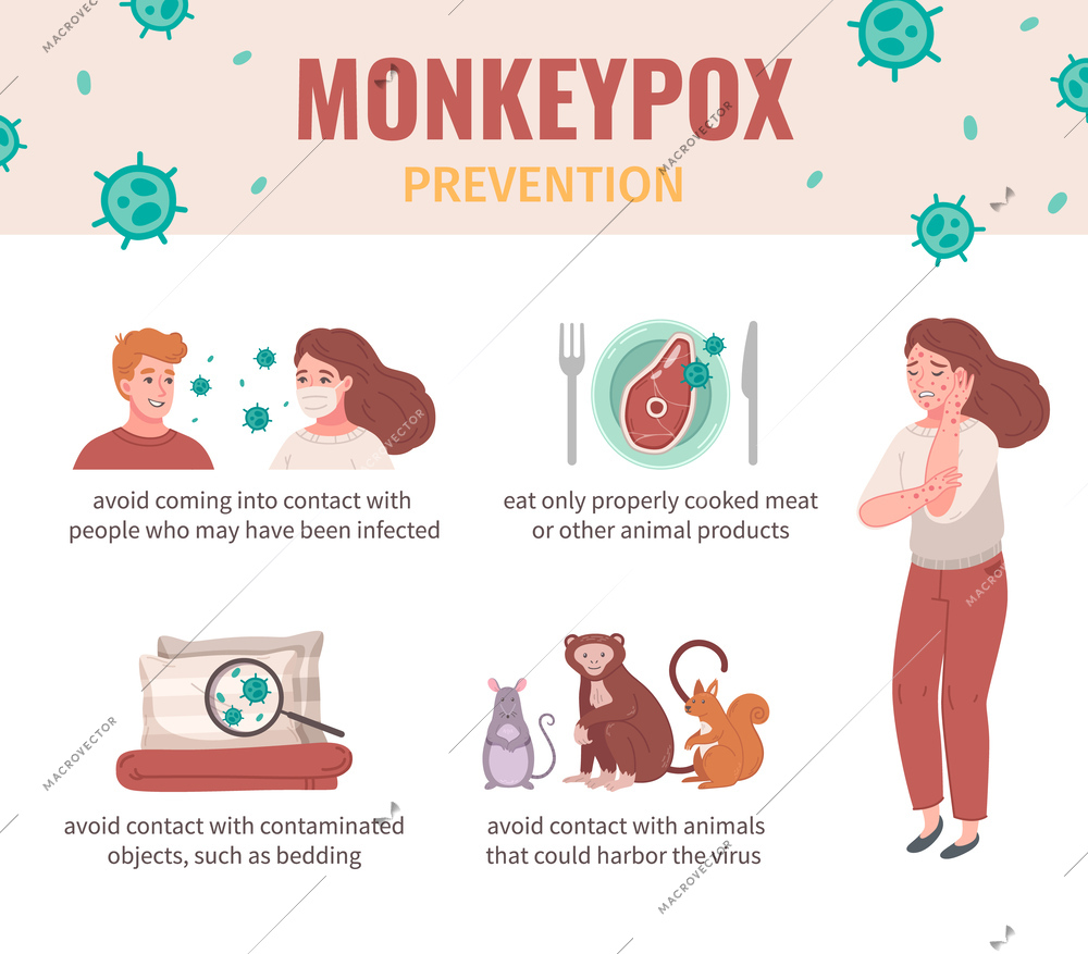 Monkey pox virus infographic set with desease prevention vector illustration