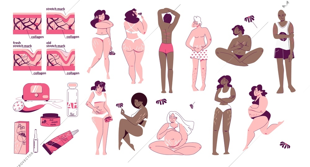 Stretch marks flat set with isolated icons of cosmetic products skin structure and human characters bodies vector illustration