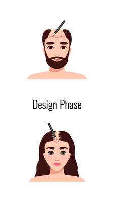 Alopecia hair transplantation composition with infographic image of hair restoration procedures with text vector illustration