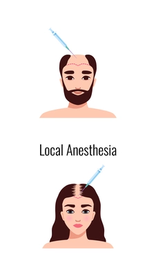 Alopecia hair transplantation composition with infographic image of hair restoration procedures with text vector illustration