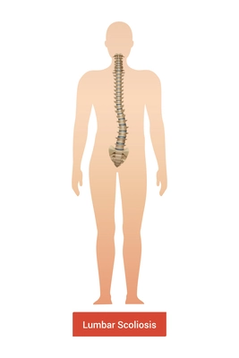 Spinal curvature scoliosis composition with anatomic view of human body silhouette with spine and text vector illustration