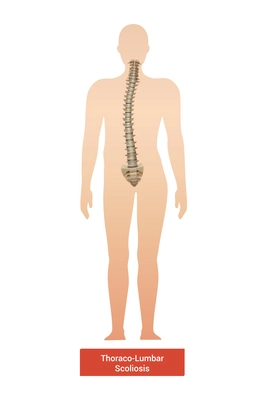 Spinal curvature scoliosis composition with anatomic view of human body silhouette with spine and text vector illustration