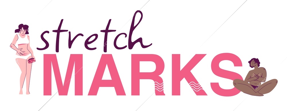 Stretch marks composition of flat text with wavy spots and characters of black and white women vector illustration