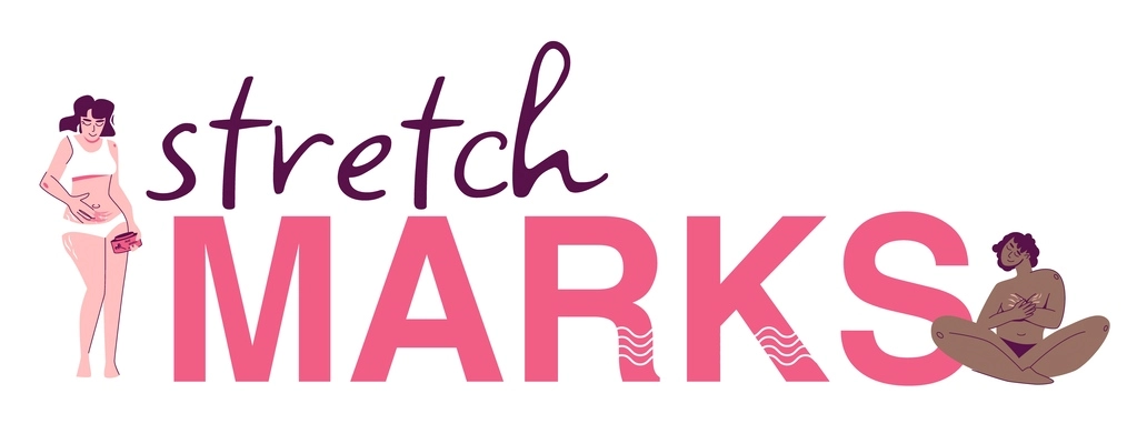 Stretch marks composition of flat text with wavy spots and characters of black and white women vector illustration