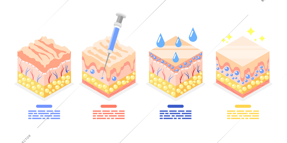 Hyaluronic acid isometric composition with set of cubes representing skin structure before and after rejuvenating injection vector illustration