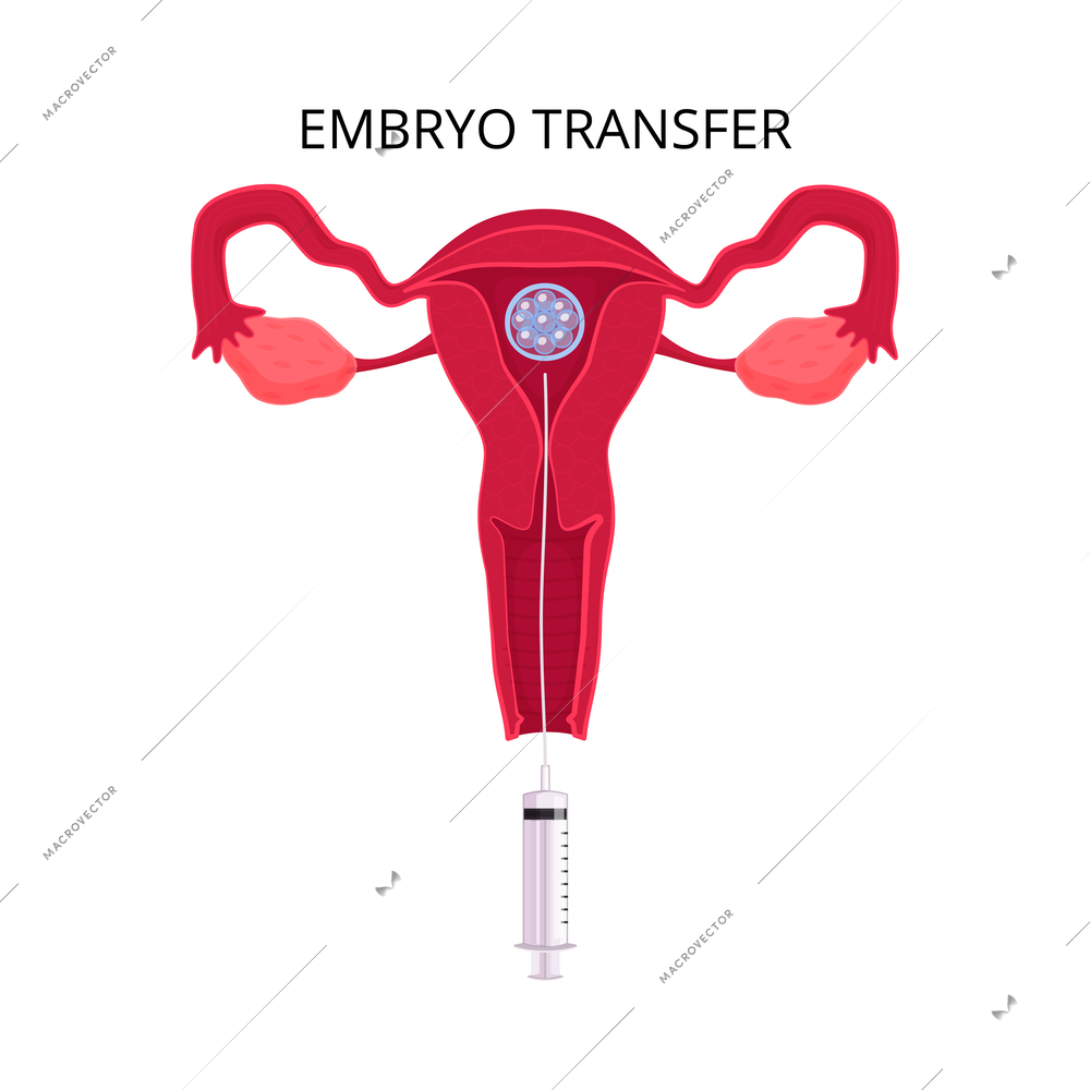 In vitro fertilization ivf flat composition with text captions and artificial insemination icons vector illustration