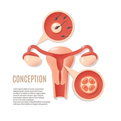 Medical genecology educational early pregnancy visualization schema fertilization and embryo implantation poster icon print abstract vector illustration