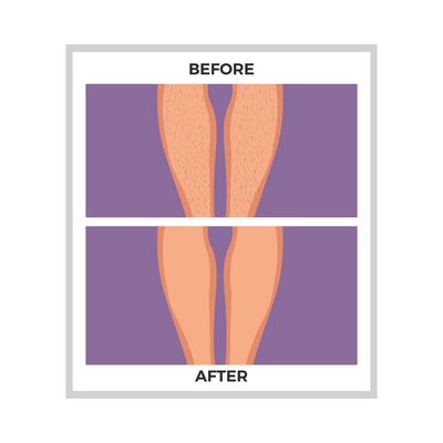 Hair removal legs before and after depilation flat vector illustration