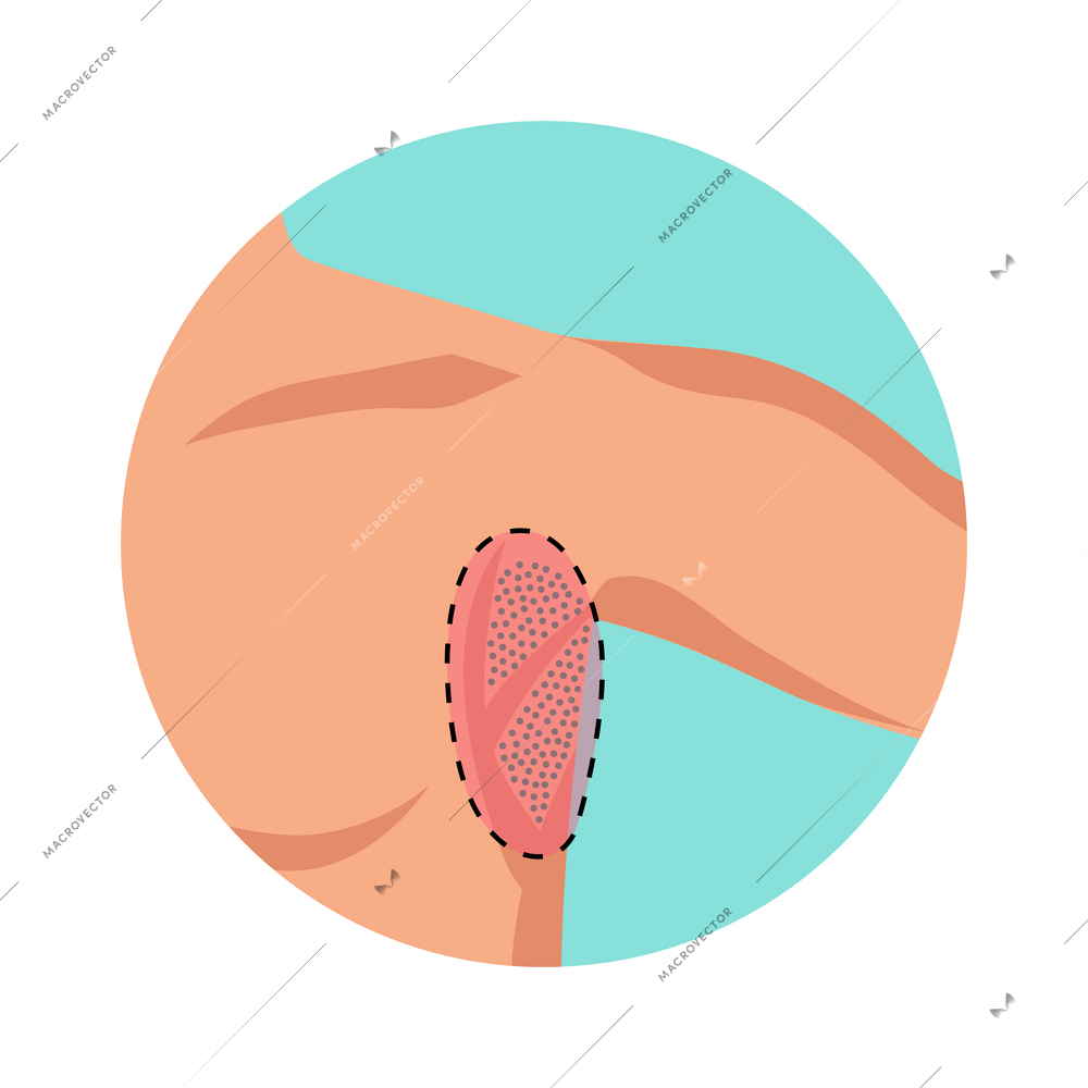 Armpit hair removal process flat round icon vector illustration