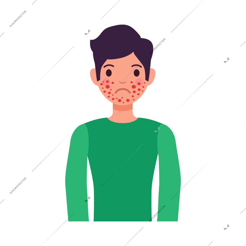 Boy sufferering from red rashes allergy symptom flat vector illustration