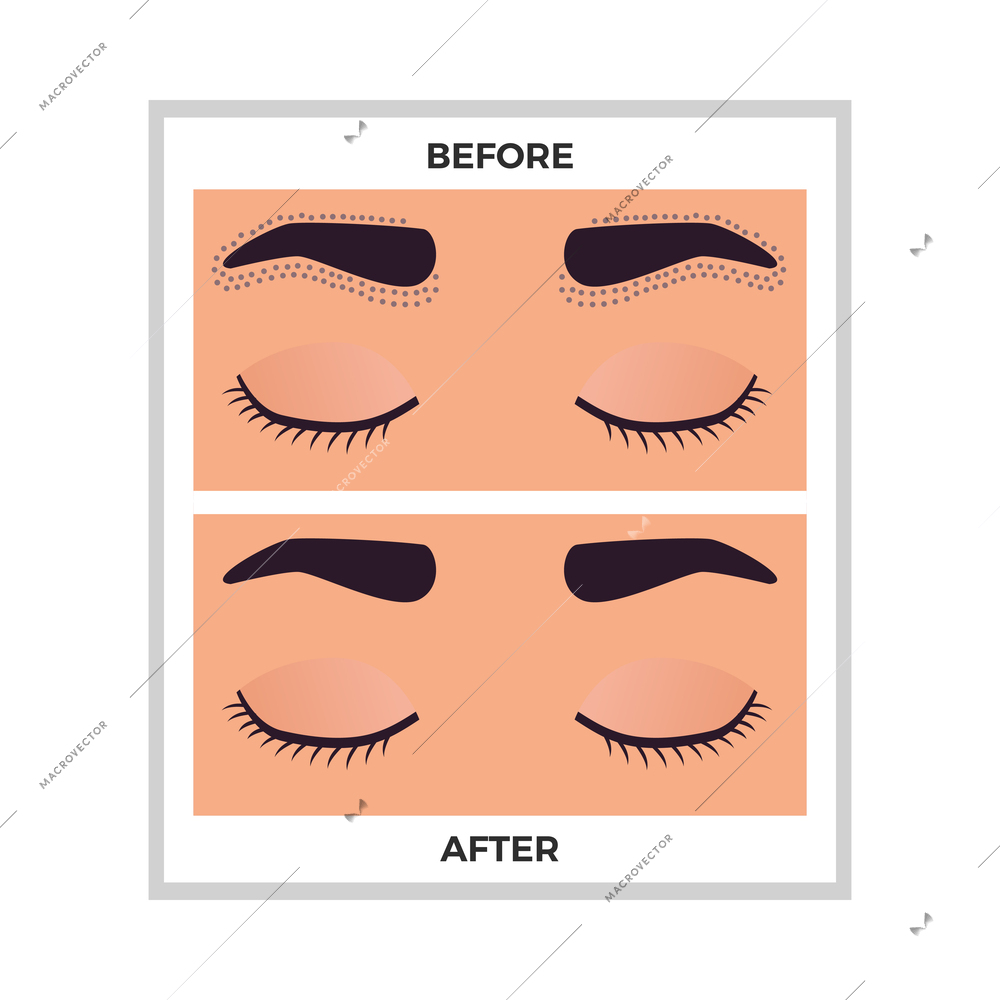 Hair removal eyebrows area before and after flat vector illustration