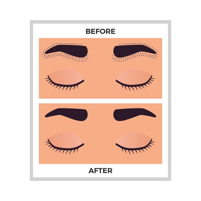 Hair removal eyebrows area before and after flat vector illustration