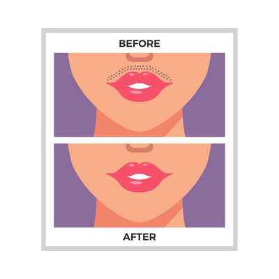 Lips area before and after hair removal flat vector illustration