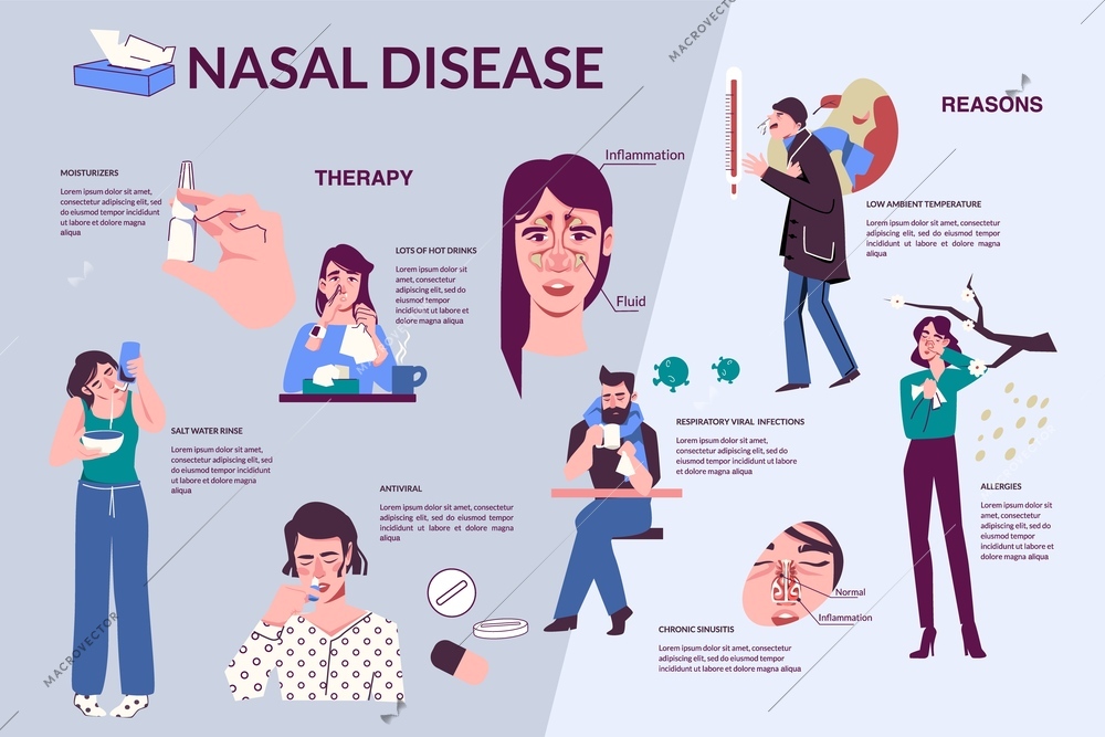 Nasal disease runny nose flat infographics with editable text attached to images of people having symptoms vector illustration