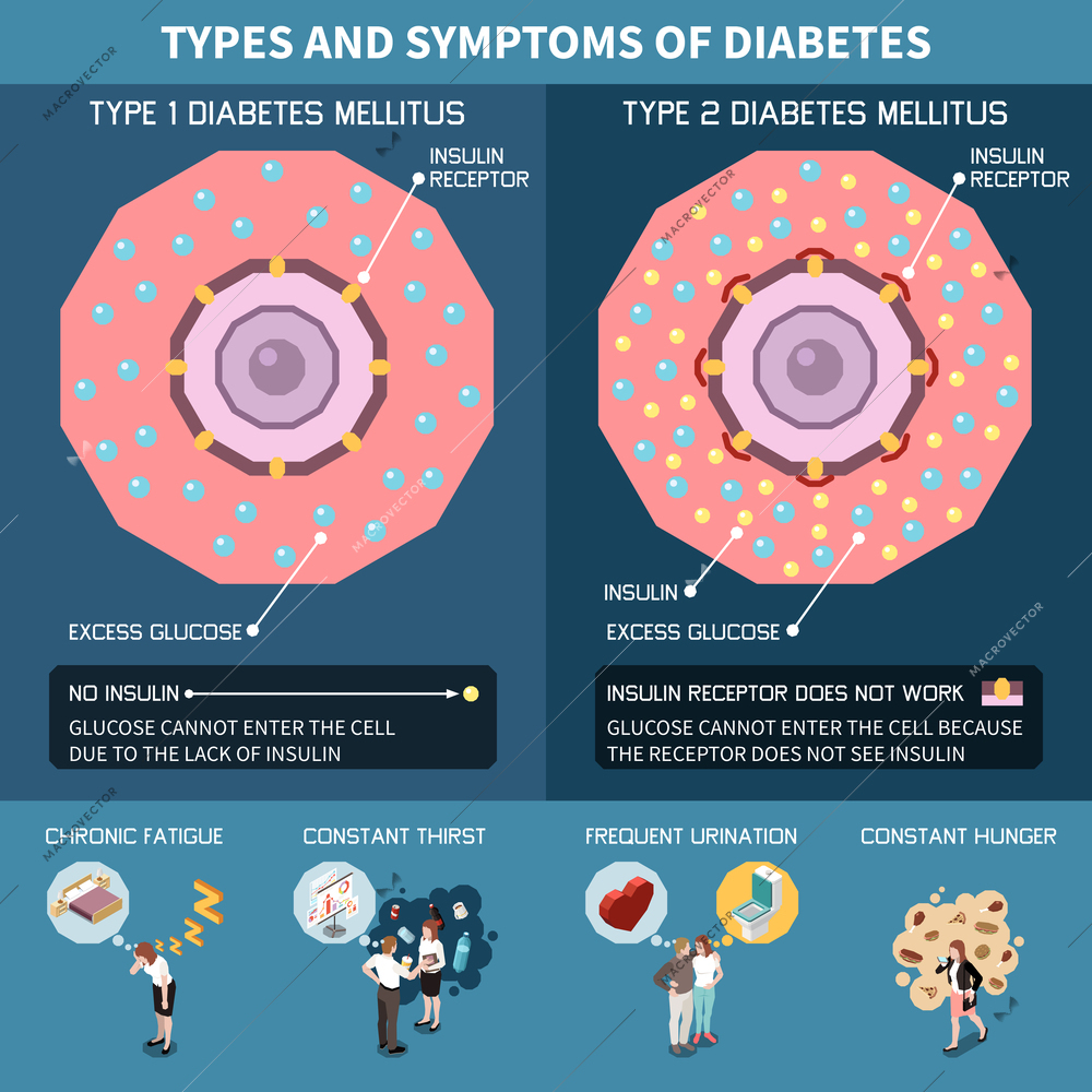 Diabetes isometric infographics with types and symptoms of desease vector illustration