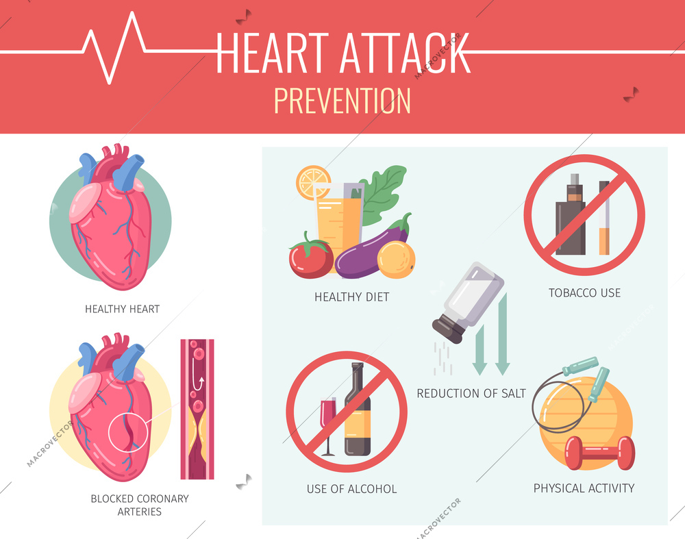 Heart attack cartoon infographics with desease prevention factors vector illustration