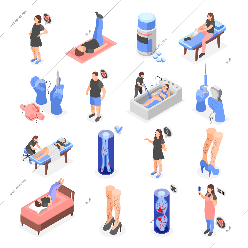 Varicose isometric set of isolated icons with human characters of patients symptoms exercises and medical supplies vector illustration