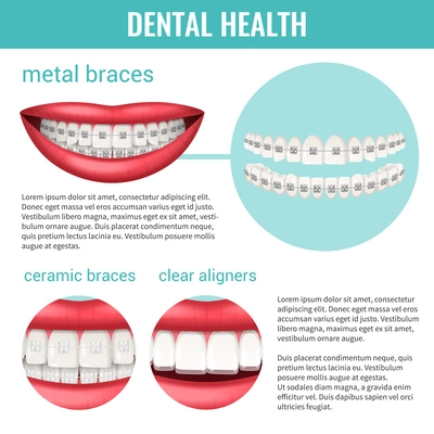 Dental health infographics set with metal and ceramic braces realistic vector illustration