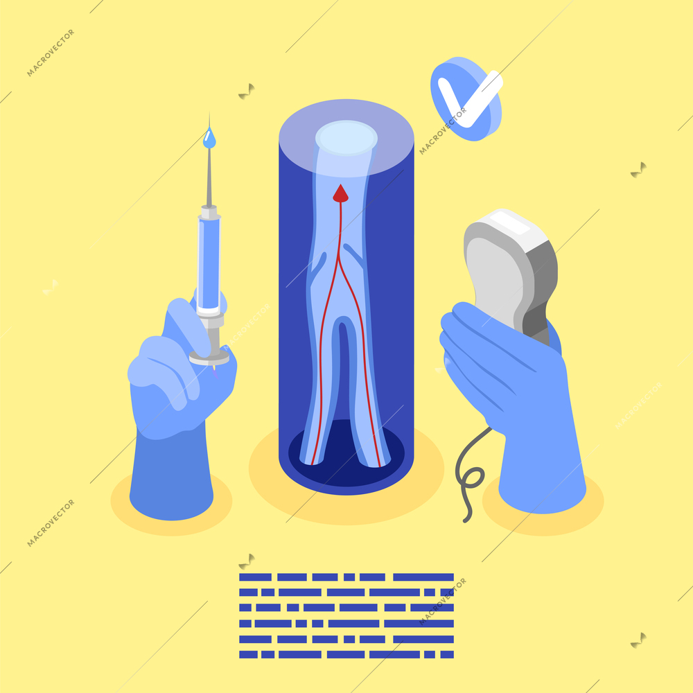 Varicose isometric background composition with text and view of vein structure with medical hands holding tools vector illustration