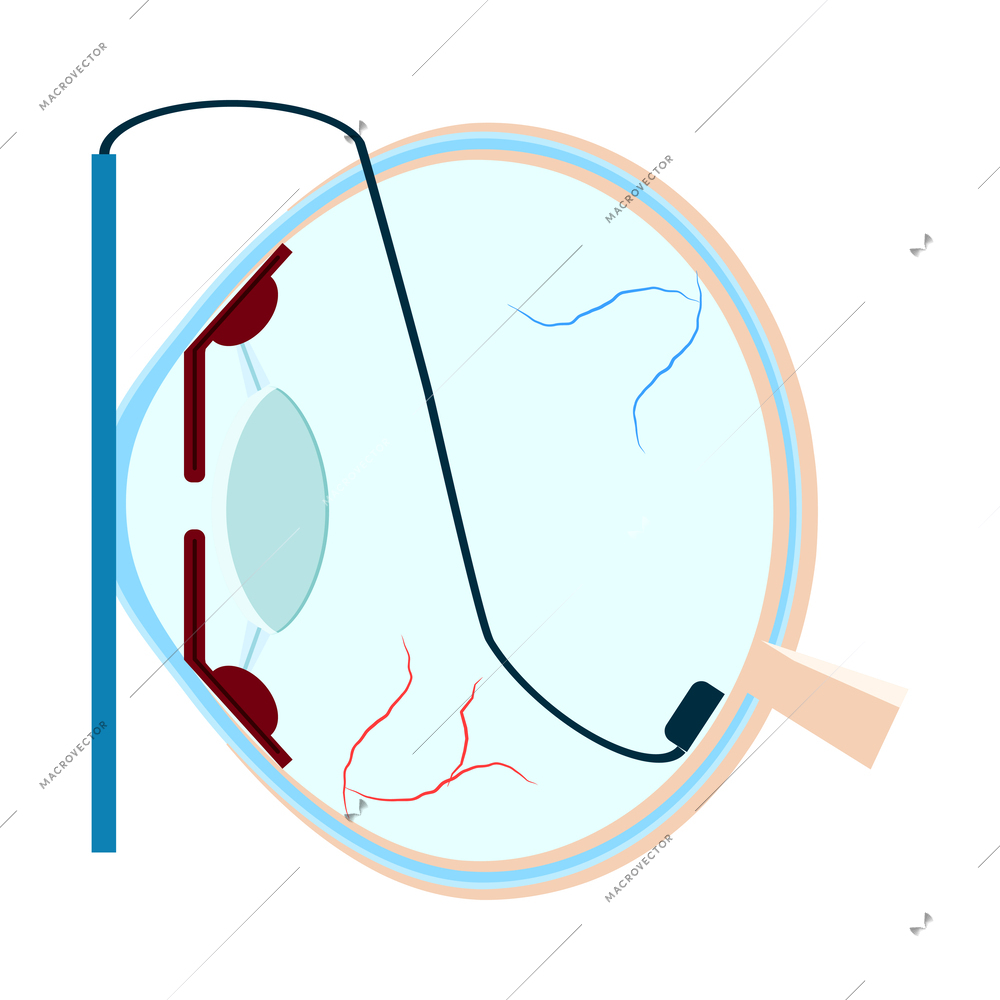 Eye prosthesis flat icon vector illustration