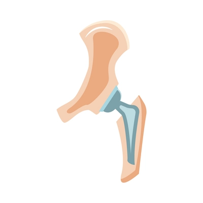 Artificial joint prosthesis flat icon vector illustration