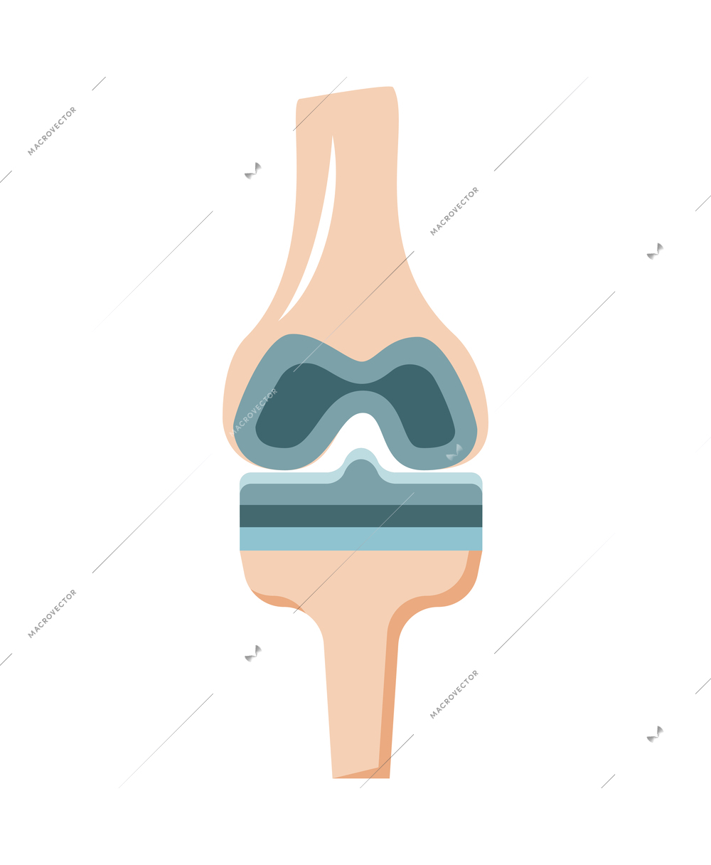Joint prosthesis knee replacement flat icon vector illustration