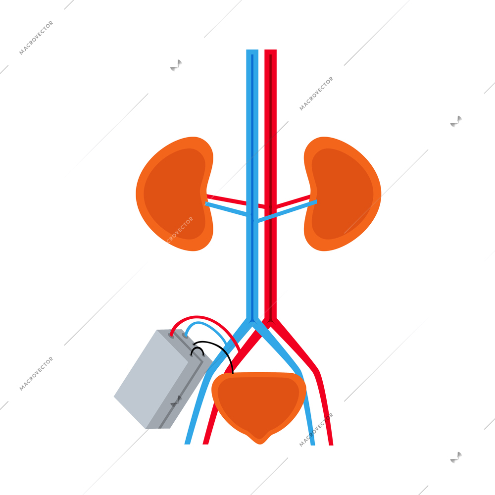 Bionic kidney prosthesis flat icon vector illustration