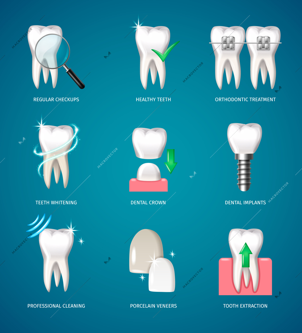 Teeth treatment realistic icons set with dental implants and artificial veneers isolated vector illustration