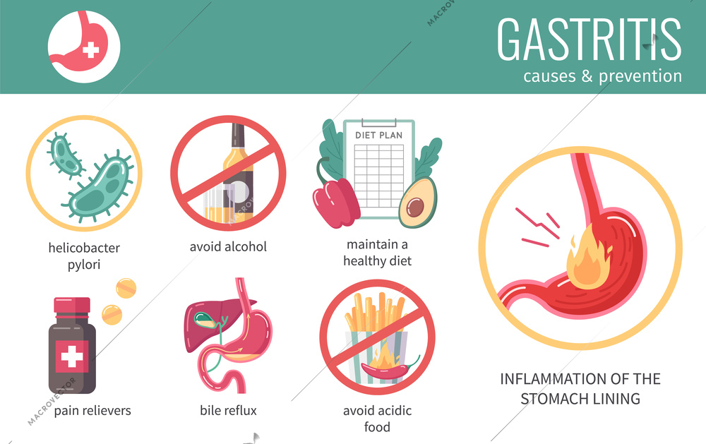 GERD flat infographics with gastritis causes and prevention symbols vector illustration