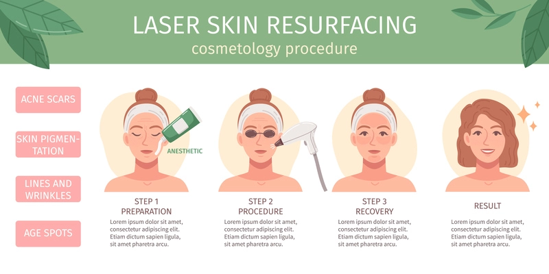 Cosmetology procedures flat cartoon infographics with laser skin resurfacing vector illustration