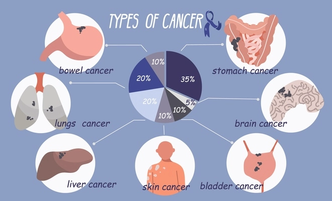 Cancer patient oncology flat infographic composition with radial chart and round compositions representing types of cancer vector illustration