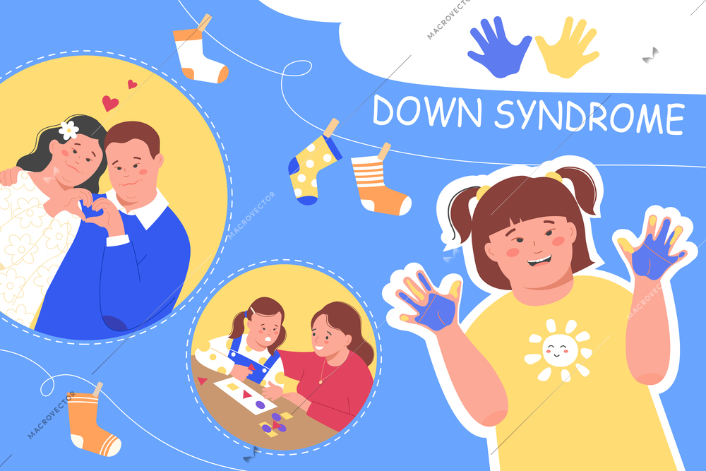 Downs syndrome flat collage composition with people in love study and creative vector illustration