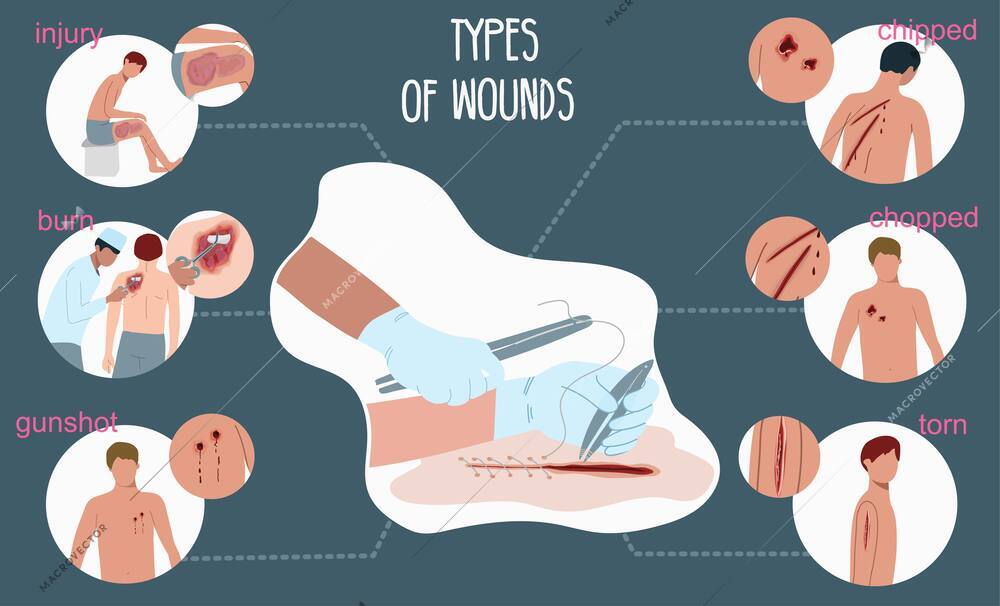 Wound people flat infographic set of round compositions showing various wound types with editable text captions vector illustration