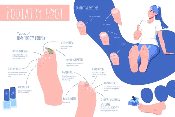 Podiatry foot disease flat infographic composition of human feet images editable text captions and arrow pointers vector illustration