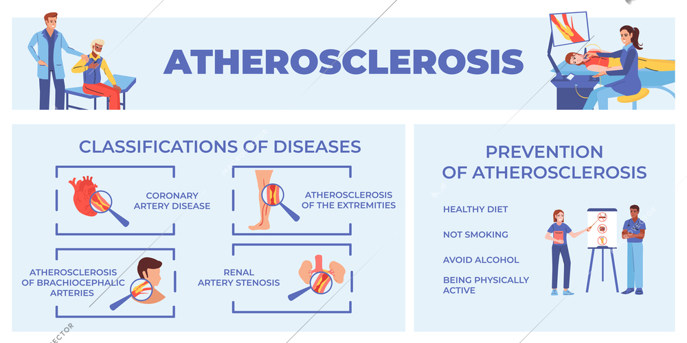 Atherosclerosis artery flat infographic composition with editable text captions classifications of diseases prevention tips and people vector illustration