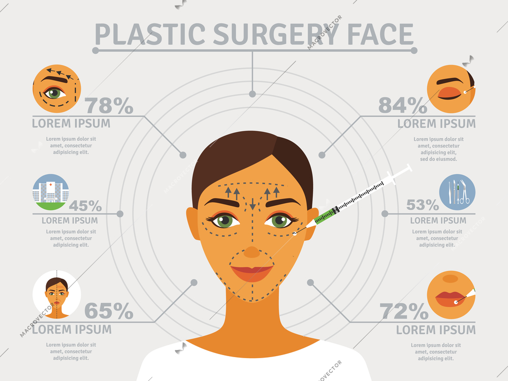 Cosmetic plastic facial surgery poster with infographic elements over eyelid correction and forehead lifts abstract vector illustration